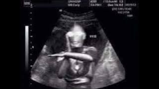 HIVI - remaja ( speed up )