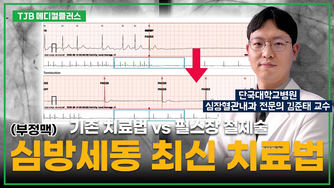 [메디컬플러스] 심방세동(부정맥)의 새로운 치료법? 펄스장 절제술! | 단국대병원 심장혈관내과 김준태 교수