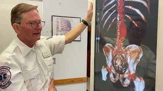 EMS Anatomage Table: Aortic Aneurysm