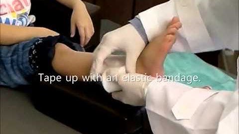 Neal Splint F/G or N/W(Product code : NHRS)