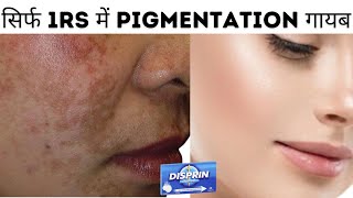 Disprin Tablets For Skin Freshness And Anti-Acne How To Use Disprin 1Rs म Pigmentation गयब