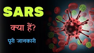 What is SARS with Full Information? – [Hindi] – Quick Support