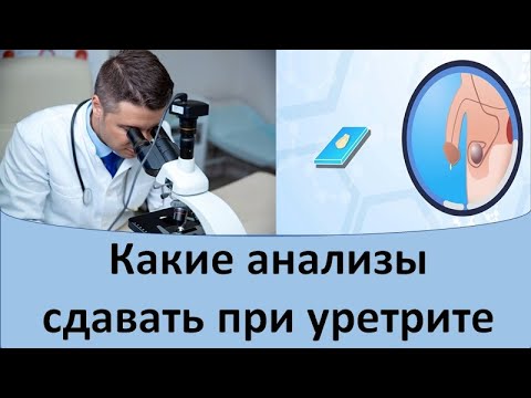 Уретрит анализы. Какие анализы сдавать на уретрит.