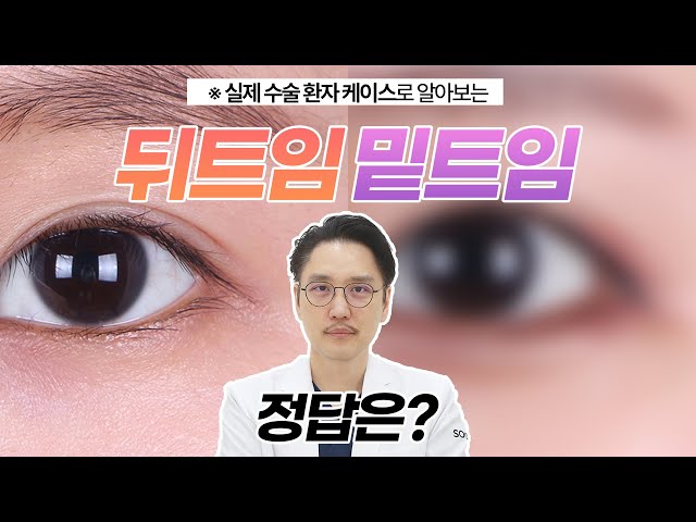 [CN]뒤트임 밑트임 정답 알려드립니다