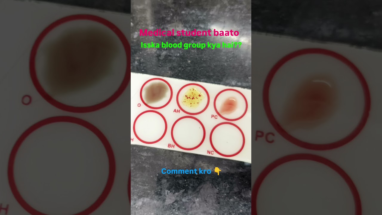 baato sb kon sa blood group hai 