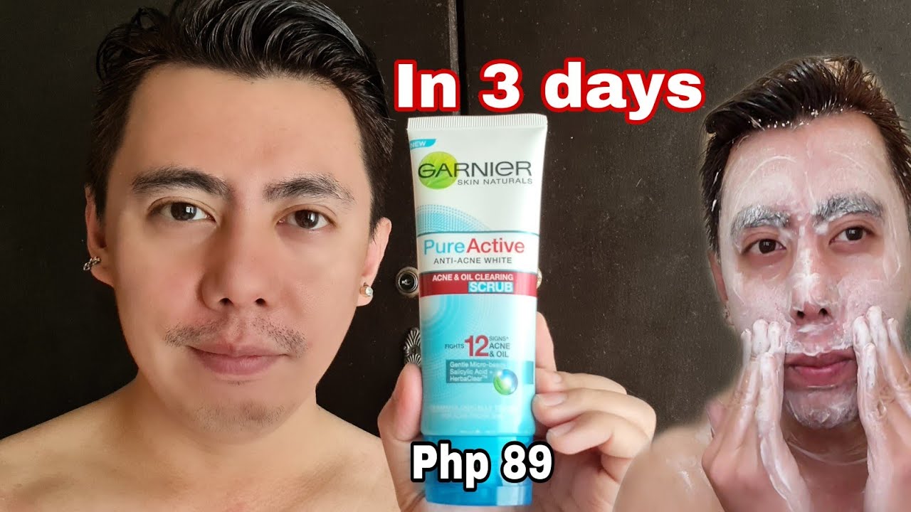 IN 3 DAYS GARNIER WHITE ANTI ACNE & OIL WHITENING FACIAL FOAM SCRUB