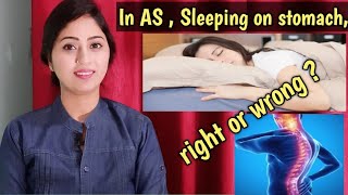 Ankylosing Spondylitis में पेट के बल सोना ,सही या गलत ?