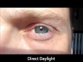 Color Contacts Demo for Blue Eyes