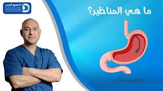 المناظير هي عبارة عن فحص دقيق لتشخيص الجهاز الهضمي | دكتور عمرو الديب