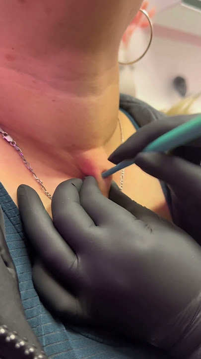 Neck Dermal Piercing 💎 by Underground Tattoos Watford #piercing #dermalpiercing