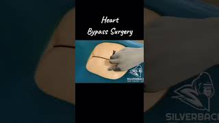 Heart bypass surgery doctor surgery  biology biologylovers  viral  tranding shortvideo