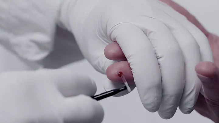 MPA method in Medonic analyzers