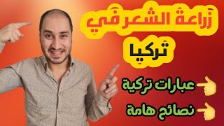 تعلم مصطلحات زراعة الشعر في تركيا ( تجربتي الشخصية ) | نصائح عليك اتباعها قبل وأثناء و بعد العملية |