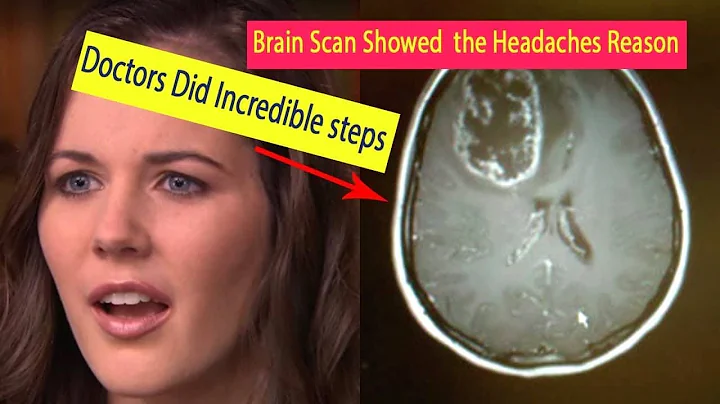 When a Brain Scan Showed What Was Behind Her Headaches, Doctors Began an Incredible Treatment - DayDayNews