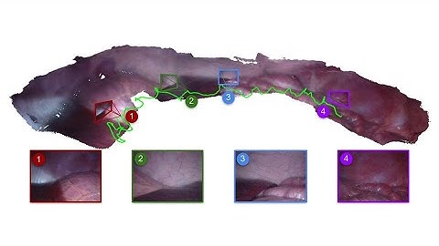 Endo-Depth-and-Motion: Reconstruction and Tracking in Endoscopic Videos
