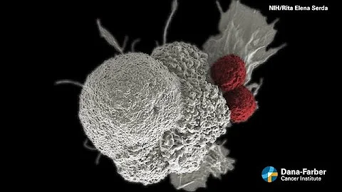 Reimagining Immunotherapy in Head and Neck Cancer:...
