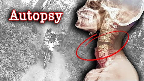 The Autopsy of Christopher Keller