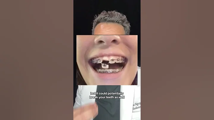 Things NOT to do when you first get Braces