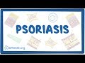 Psoriasis - causes, symptoms, diagnosis, treatment, pathology