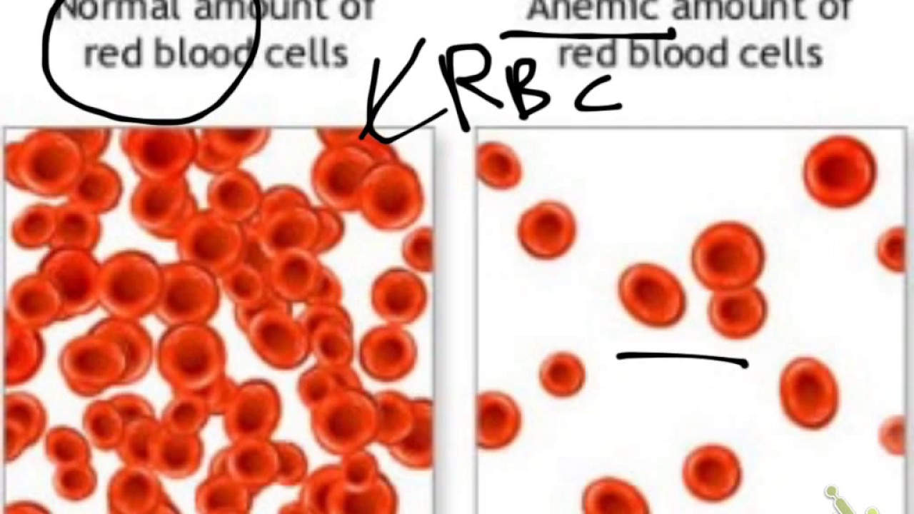Introduction to HLS pathology - YouTube