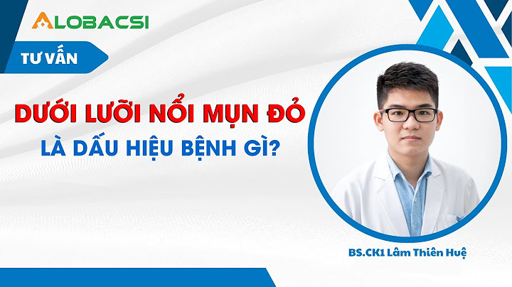 Lưỡi có màu tím là bệnh gì