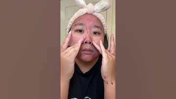 Get rid of your acne quick and easy by using Norse Organic 🫶🏼 #skincare #acne #acneskincareroutine