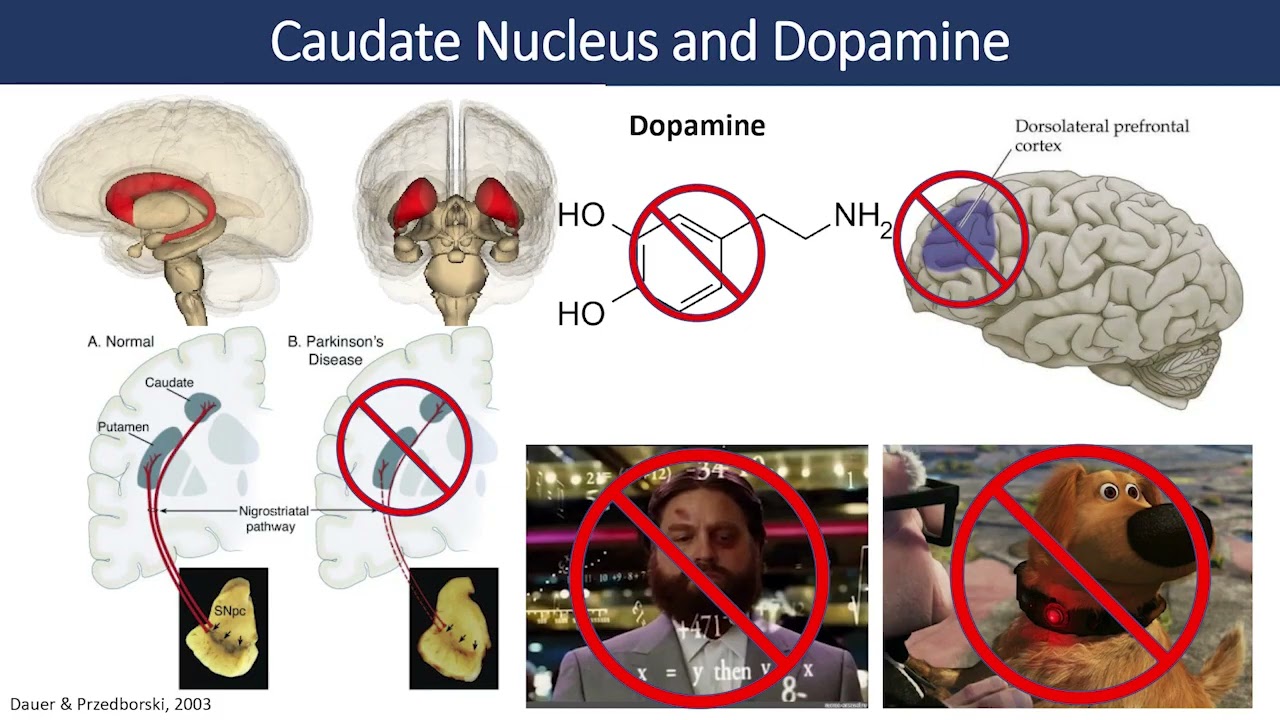 Parkinson’s Disease & You: ACETYLCHOLINE AND COGNITION IN PARKINSON’S DISEASE