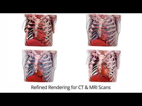 Table 8 enables Anatomage Bodies to evolve into living human bodies that look, respond, and function just like us.