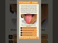Medical Quizzes #medical #medicine #paediatrics #nursing #medicalstudent #nursingstudent #gnm