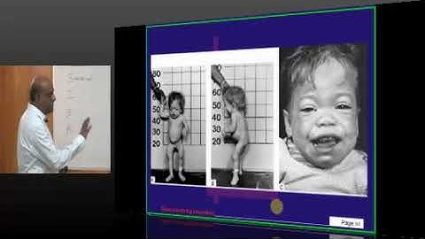 NEETPG Image based MCQ Mock Test Discussion 1630 Lec 01 Download uMedico App