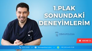 1. Plak Sonundaki Deneyimlerim | Prof. Dr. Mehmet Oğuz Öztoprak | Dentapolitan