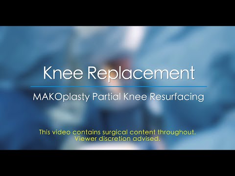 MAKOplasty® Partial Knee Resurfacing - Dr. Andreas Gomoll HSS New York