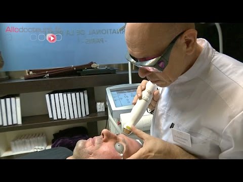 Vidéo: Traitement Au Laser Pour Les Cicatrices: Coût, Efficacité, Visage Et Plus