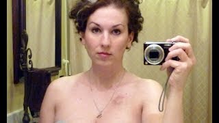 A Year of Breast Cancer