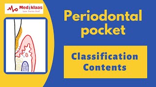 Periodontal Pocket l Periodontal disease l Classification and contents l Mediklaas
