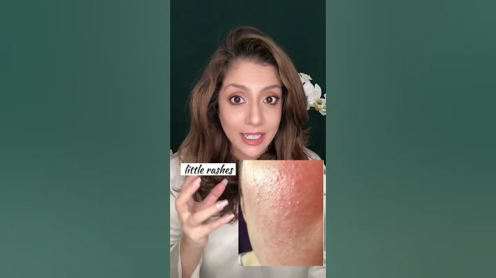 Repair & build your natural skin barrier #shorts #shortsvideo