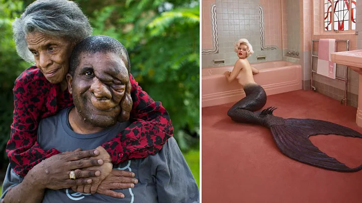 15 Shocking People You Won’t Believe Exist!