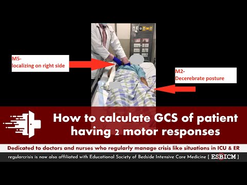 How To Calculate GCS Of The Patient Having 2 Different Motor Response On Two Sides Regularcrisis