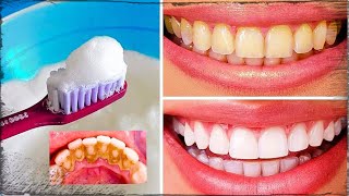صدق او لا تصدق/ تبيض الاسنان في دقيقة واحدة فقط والتخلص من البلاك والجير المزعج جربوها