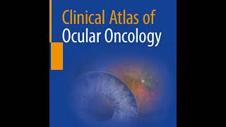 Clinical Atlas of Ocular Oncology