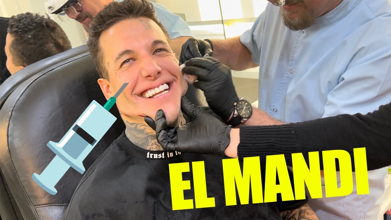 ME HAGO MARCACIÓN MANDIBULAR - ALEXANDER CANIGGIA