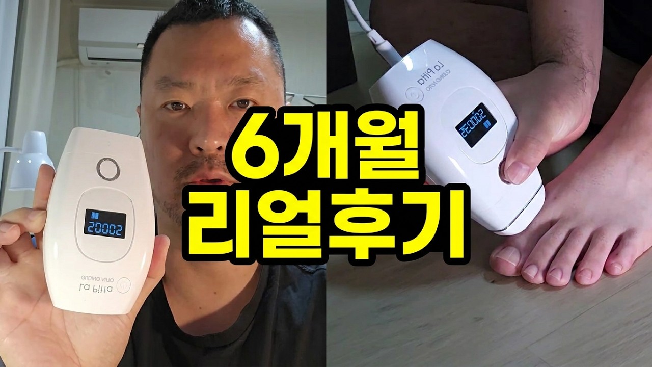 Easy hair removal at home! Home laser hair removal machine