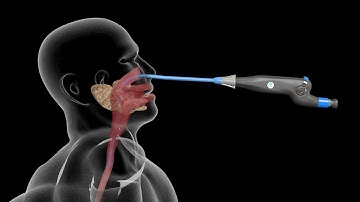 PatCom Introducer for safe and comfortable placement of NG-tubes, HRM catheters and 24h pH probes