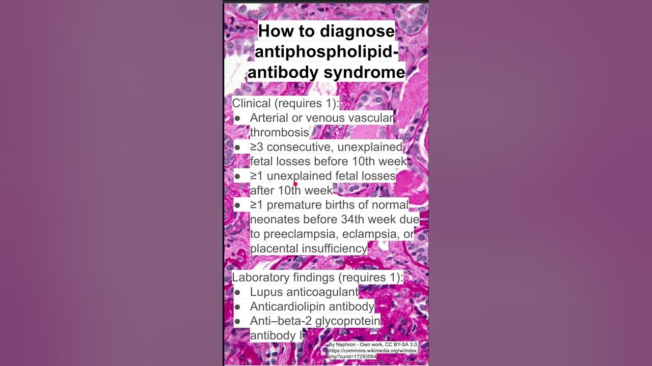 How Do We Diagnose Lung Cancer