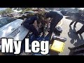 Motorcycle gets HIT by a TRUCK! |Messed up his Leg