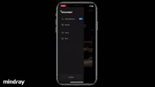 Mindray TE Air Tutorial — Scanning in M Mode