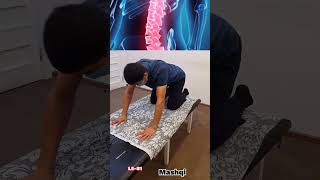 l5 s1 davolash #latestnews #shortsvideo #lifehacks