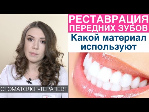 Реставрация передних зубов - какие пломбировочные (композиционные) материалами используют