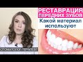 Реставрация передних зубов - какие пломбировочные (композиционные) материалами используют