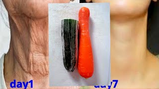 وصفات منزلية لمكافحة الشيخوخة للتخلص من تجاعيد الرقبة تمامًا ❤ أفضل علاج لتجاعيد الرقبة